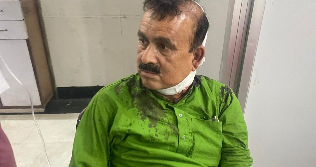 किन आक्रमणमा परे कांग्रेस सहमहामन्त्री यादव ?